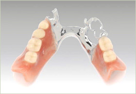 入れ歯 奥歯 の 一番奥の歯1本だけを入れ歯にすることは可能ですか？
